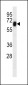 RYK Antibody
